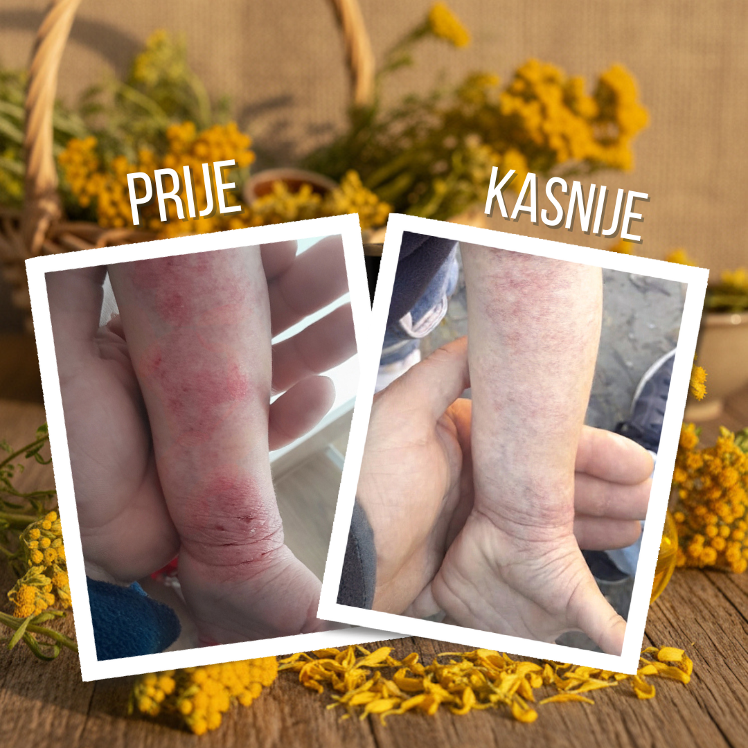 ZLATNA KAP BESMRTNOSTI